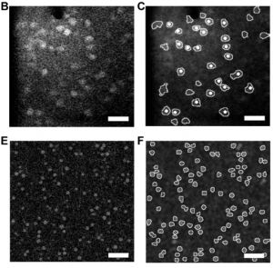 Commoditizing population calcium imaging analysis – Labrigger
